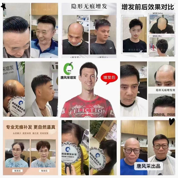 武昌區(qū)定制假發(fā) \