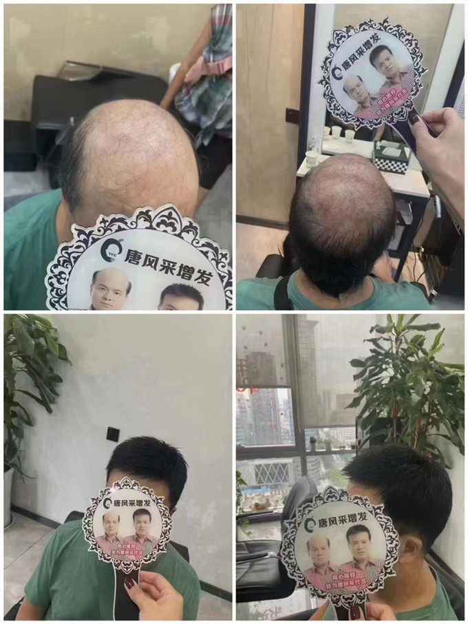大同假發(fā)服務(wù)中心 \
