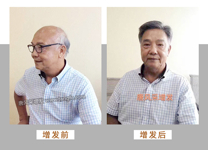 烏魯木齊定制男士假發(fā) \