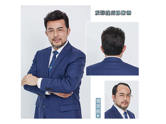 東莞什么地方有假發(fā)實體店 \