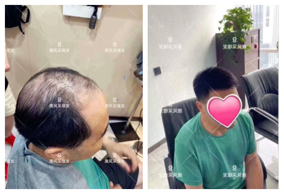 東莞什么地方有假發(fā)實體店 \
