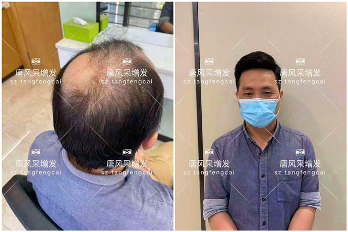 東莞什么地方有假發(fā)實體店 \