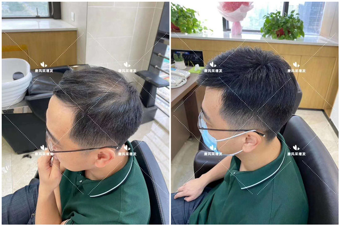 北京朝陽(yáng)假發(fā)專賣店哪里有 \