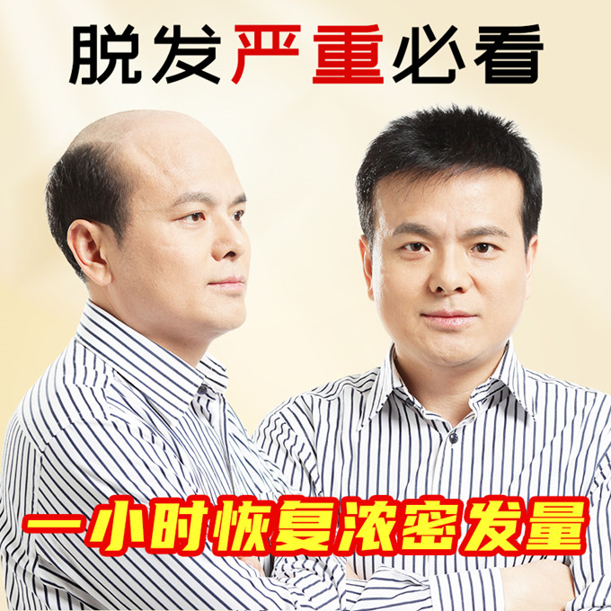 北京朝陽(yáng)假發(fā)專賣店哪里有 \