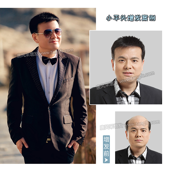 硚口區(qū)假發(fā)專(zhuān)賣(mài)店地址 \