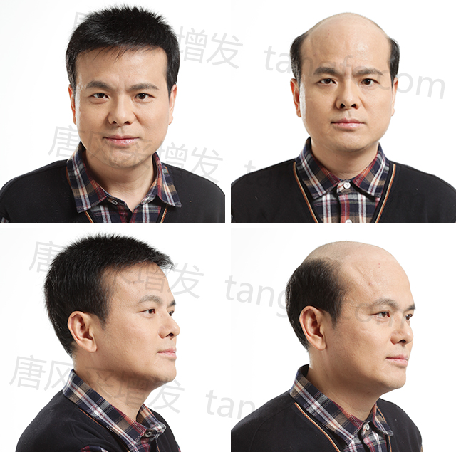 硚口區(qū)假發(fā)專(zhuān)賣(mài)店地址 \