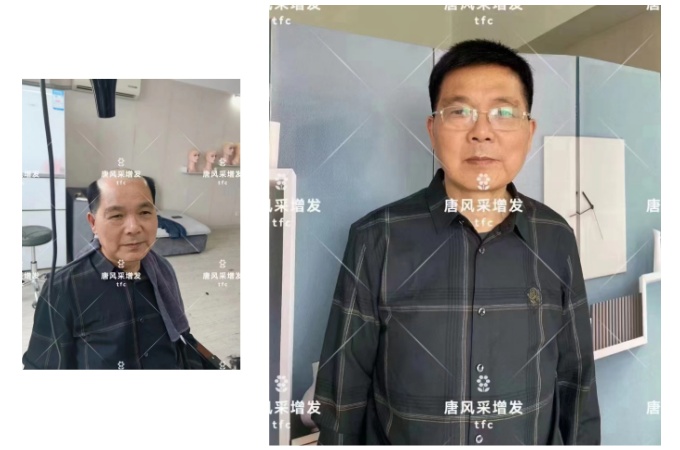 重慶有可以定假發(fā)的地方嗎 \