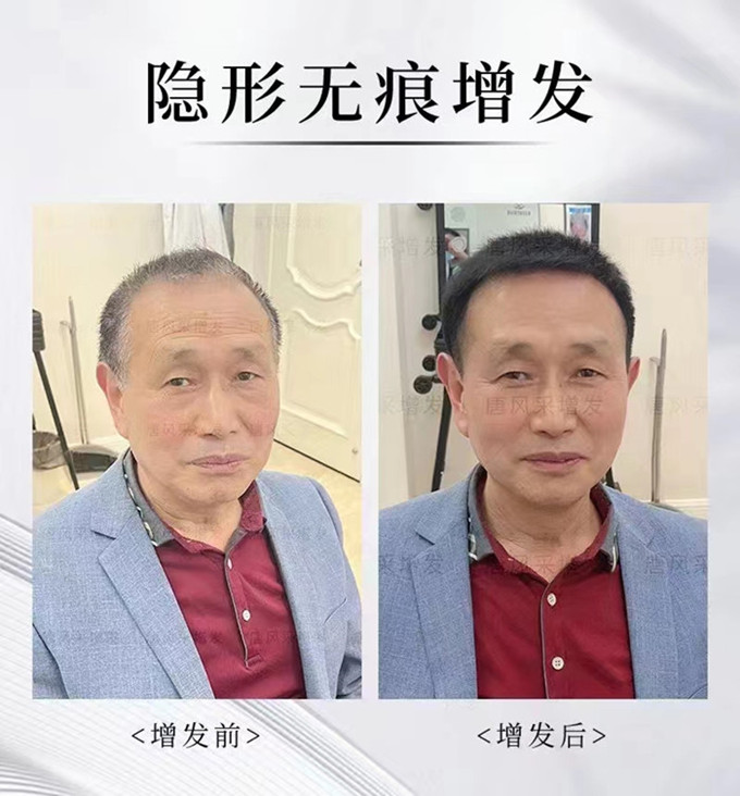 哈爾濱定制假發(fā) \