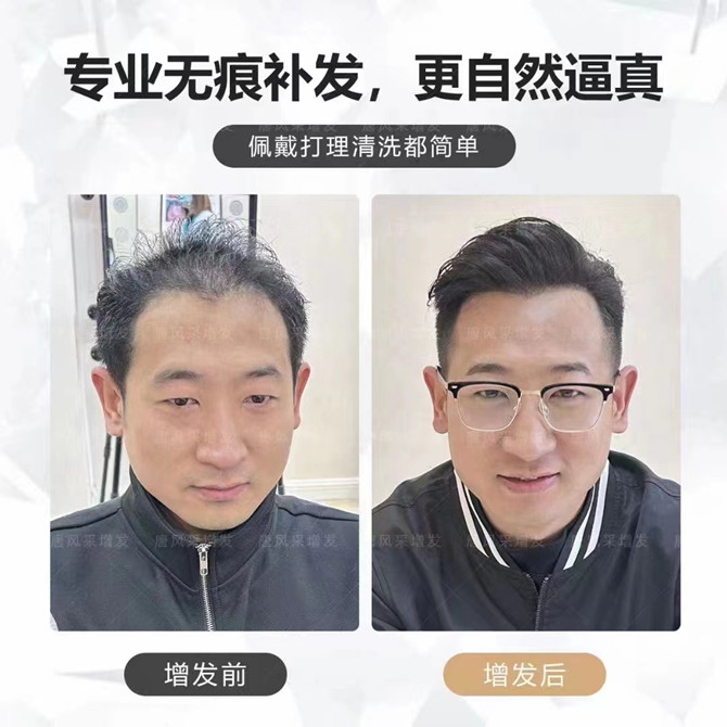 哈爾濱定制假發(fā) \