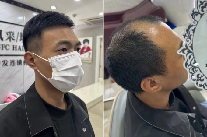 唐風采徐州補發(fā)假發(fā)中心 \