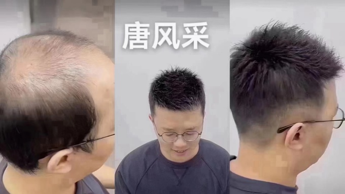 唐風采徐州補發(fā)假發(fā)中心 \