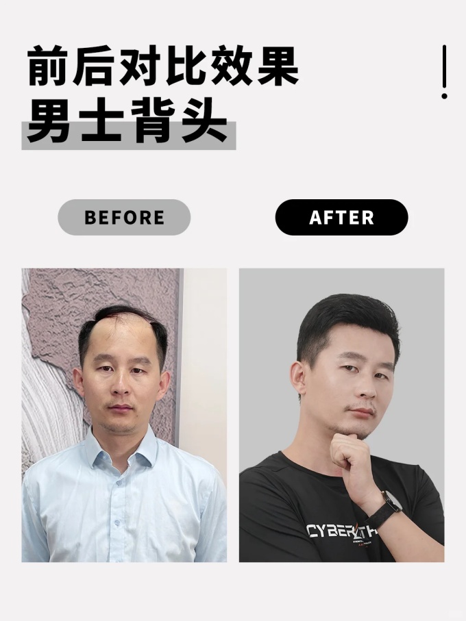 西寧假發(fā)哪家好 \