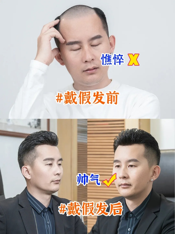 西寧假發(fā)哪家好 \
